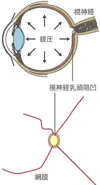 視神経乳頭陥凹